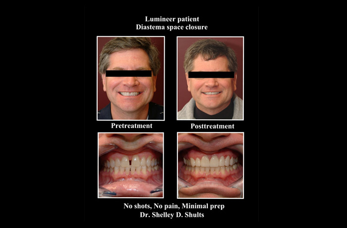 smile gallery 43065