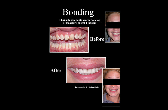 dental images 43065