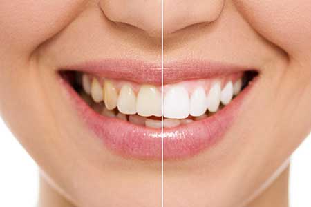 Cosmetic Dentistry Powell