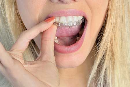 Orthodontics Dublin